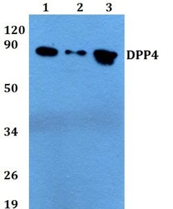 Invitrogen CD26 Polyclonal Antibody 100 &mu;L; Unconjugated:Antibodies,