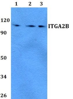 Invitrogen CD41 Polyclonal Antibody 100 &mu;L; Unconjugated:Antibodies,