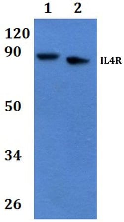 Invitrogen IL4R Polyclonal Antibody 100 &mu;L; Unconjugated:Antibodies,