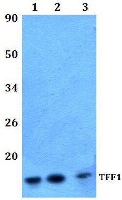 Invitrogen TFF1 Polyclonal Antibody 100 &mu;L | Buy Online | Invitrogen&trade; | Fisher Scientific