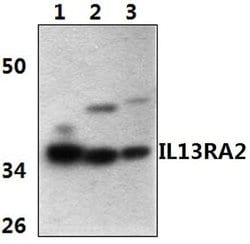 Invitrogen IL13RA2 Polyclonal Antibody 100 &mu;L; Unconjugated:Antibodies,