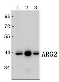 Invitrogen Arginase 2 Polyclonal Antibody 100 &mu;L; Unconjugated:Antibodies,