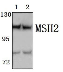 Invitrogen MSH2 Polyclonal Antibody 100 &mu;L; Unconjugated:Antibodies,