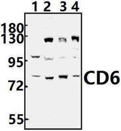 Invitrogen CD6 Polyclonal Antibody 100 &mu;L; Unconjugated:Antibodies,