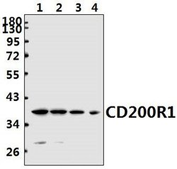 Invitrogen CD200R Polyclonal Antibody 100 &mu;L | Buy Online | Invitrogen&trade; | Fisher Scientific