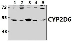 Invitrogen CYP2D6 Polyclonal Antibody 100 &mu;L; Unconjugated:Antibodies,