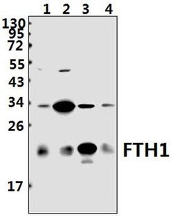 Invitrogen Ferritin Heavy Chain Polyclonal Antibody 100 &mu;L; Unconjugated:Antibodies,