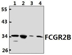 Invitrogen CD32b Polyclonal Antibody 100 &mu;L; Unconjugated:Antibodies,