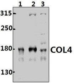 Invitrogen Collagen IV Polyclonal Antibody 100 &mu;L; Unconjugated:Antibodies,