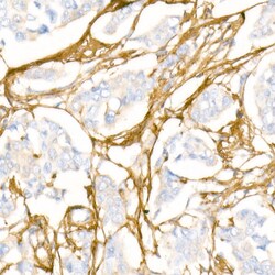 Invitrogen COL1A1 Polyclonal Antibody 100 &mu;L | Buy Online | Invitrogen&trade; | Fisher Scientific