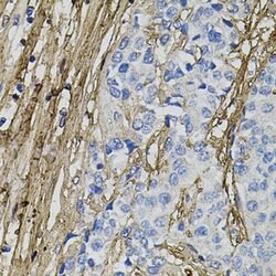 Invitrogen COL1A1 Polyclonal Antibody 100 &mu;L | Buy Online | Invitrogen&trade; | Fisher Scientific