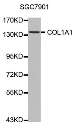 Invitrogen COL1A1 Polyclonal Antibody 100 &mu;L | Buy Online | Invitrogen&trade; | Fisher Scientific