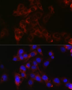 Invitrogen Apolipoprotein B Polyclonal Antibody 100 &mu;L; Unconjugated:Antibodies,