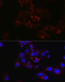 Invitrogen Apolipoprotein B Polyclonal Antibody 100 &mu;L; Unconjugated:Antibodies,