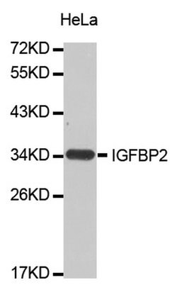 Invitrogen IGFBP2 Polyclonal Antibody 100 &mu;L; Unconjugated:Antibodies,