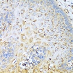 Invitrogen MYH9 Polyclonal Antibody 100 &mu;L; Unconjugated:Antibodies,