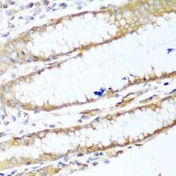 Invitrogen MYH9 Polyclonal Antibody 100 &mu;L; Unconjugated:Antibodies,
