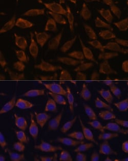 Invitrogen NOTCH2 Polyclonal Antibody 100 &mu;L; Unconjugated:Antibodies,