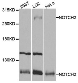 Invitrogen NOTCH2 Polyclonal Antibody 100 &mu;L; Unconjugated:Antibodies,