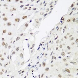 Invitrogen HP1 gamma Polyclonal Antibody 100 &mu;L; Unconjugated:Antibodies,