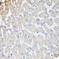 Invitrogen COX5B Polyclonal Antibody 100 &mu;L; Unconjugated:Antibodies,