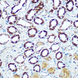 Invitrogen COX5B Polyclonal Antibody 100 &mu;L; Unconjugated:Antibodies,