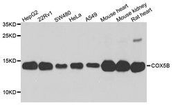 Invitrogen COX5B Polyclonal Antibody 100 &mu;L; Unconjugated:Antibodies,