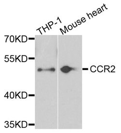 Invitrogen CCR2 Polyclonal Antibody 100 &mu;L; Unconjugated:Antibodies,
