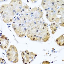 Invitrogen NuMA Polyclonal Antibody 100 &mu;L; Unconjugated:Antibodies,
