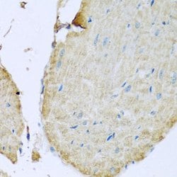 Invitrogen STING Polyclonal Antibody 100 &mu;L; Unconjugated:Anticuerpos