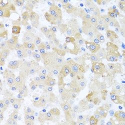 Invitrogen Centrin 1 Polyclonal Antibody 100 &mu;L; Unconjugated:Antibodies,