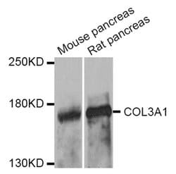 Invitrogen Collagen III Polyclonal Antibody 100 &mu;L; Unconjugated:Antibodies,
