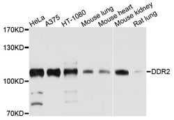 DDR2 Polyclonal Antibody:Antibodies, Polyclonal