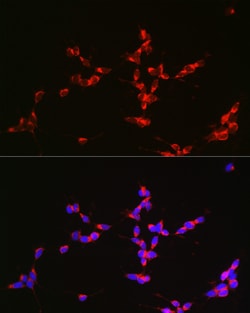 Invitrogen Glutaminase Polyclonal Antibody 100 &mu;L; Unconjugated:Antibodies,