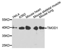 Invitrogen TMOD1 Polyclonal Antibody 100 &mu;L; Unconjugated:Antibodies,