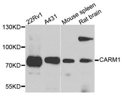 PRMT4 Polyclonal Antibody:Antibodies, Polyclonal