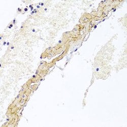 Invitrogen CD81 Polyclonal Antibody 100 &mu;L; Unconjugated:Antibodies,