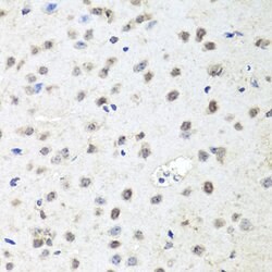Invitrogen AGO2 Polyclonal Antibody 100 &mu;L; Unconjugated:Antibodies,