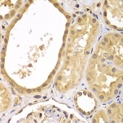 Invitrogen XIAP Polyclonal Antibody 100 &mu;L; Unconjugated:Antibodies,