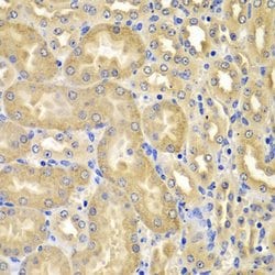 Invitrogen XIAP Polyclonal Antibody 100 &mu;L; Unconjugated:Antibodies,