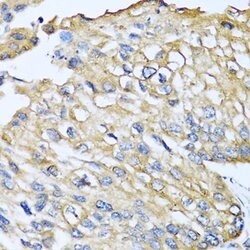 Invitrogen MCP-2 Polyclonal Antibody 100 &mu;L; Unconjugated:Antibodies,