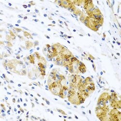 Invitrogen MCP-2 Polyclonal Antibody 100 &mu;L; Unconjugated:Antibodies,