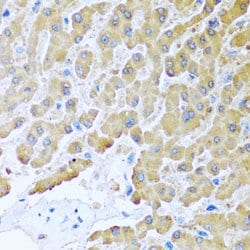 Invitrogen MCP-2 Polyclonal Antibody 100 &mu;L; Unconjugated:Antibodies,