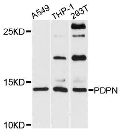 Invitrogen Podoplanin Polyclonal Antibody 100 &mu;L; Unconjugated:Antibodies,