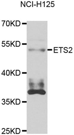 Invitrogen ETS2 Polyclonal Antibody 100 &mu;L; Unconjugated:Antibodies,