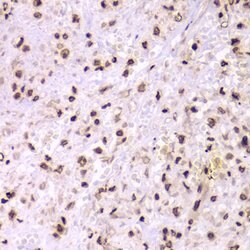 Invitrogen Ku70 Polyclonal Antibody 100 &mu;L; Unconjugated:Antibodies,