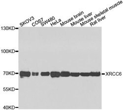 Invitrogen Ku70 Polyclonal Antibody 100 &mu;L; Unconjugated:Antibodies,