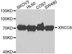 Invitrogen Ku70 Polyclonal Antibody 100 &mu;L; Unconjugated:Antibodies,