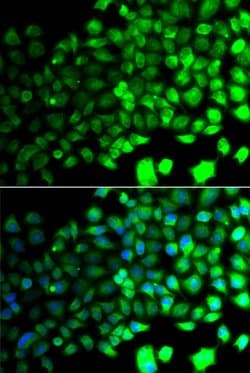 Invitrogen AMPK alpha-2 Polyclonal Antibody 100 &mu;L; Unconjugated:Antibodies,