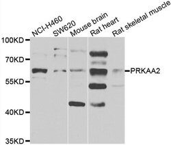 Invitrogen AMPK alpha-2 Polyclonal Antibody 100 &mu;L; Unconjugated:Antibodies,